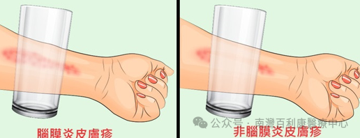 c8393d2924b876ef7137e0c31172b190.png