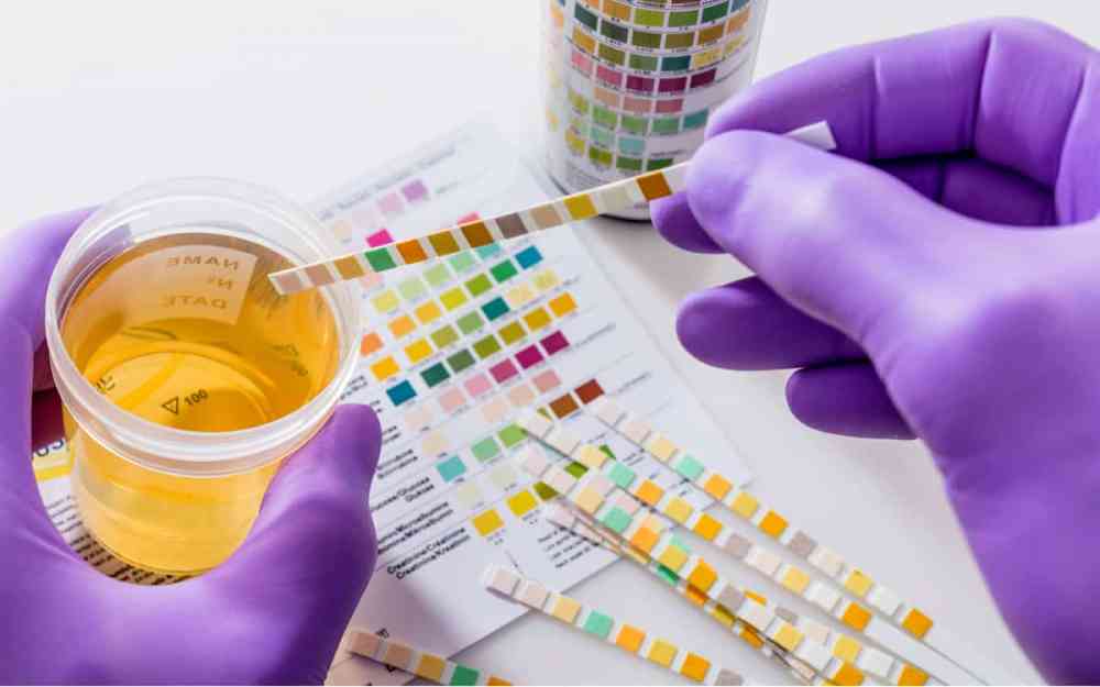【醫療情報站】不可忽視的尿液檢查，關注健康，你我做得到！