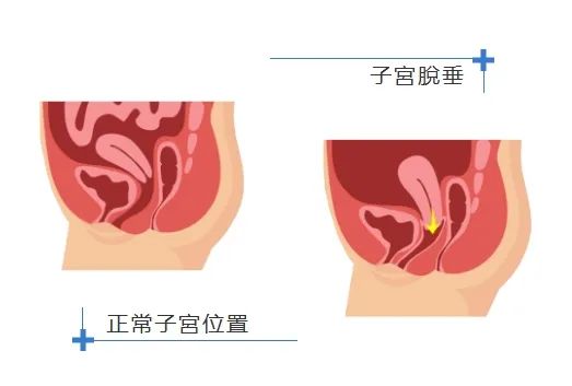 WeChat 截圖_20250320181635.png